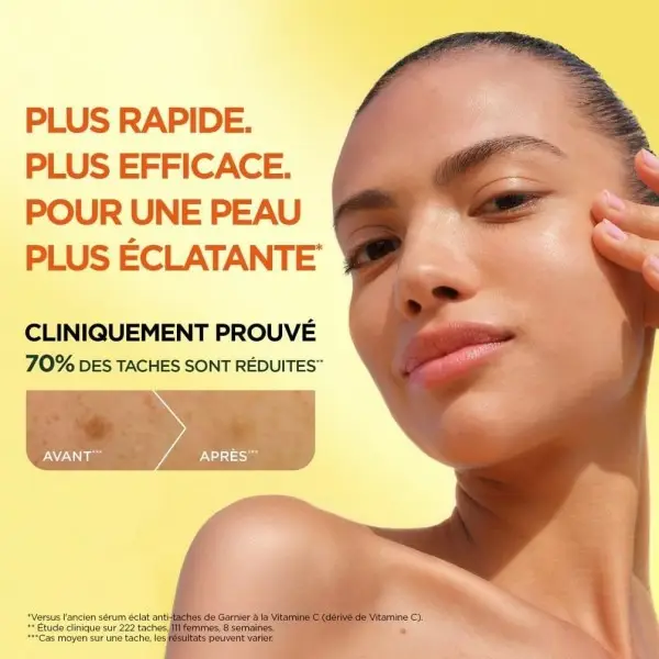 GARNIER Skin Active Sérum Éclat anti-taches brunes verrijkt met niacinamide, vitamine C en salicylzuur 8,00 €
