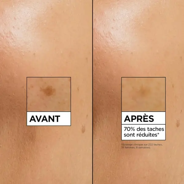 Siero Anti-Macchie Brune Trattamento Viso Arricchito con Vitamina C, Acido Salicilico e Niacinamide di Garnier SkinActive