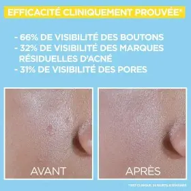 GARNIER SkinActive Daily Mattifying Anti-Imperfection Anti‑UV Fluid - SPF 50+ - Enriched with BHA & Niacinamide
