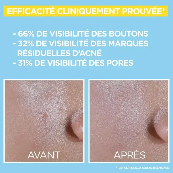 Anti-UV fluid matificerend en anti-onzuiverheden dagelijks - SPF 50+ - Verrijkt met BHA en niacinamide van GARNIER SkinActive