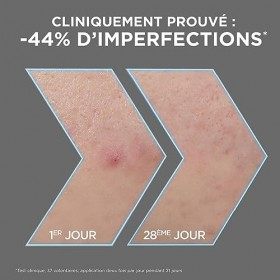 Garnier - Pure Active - Sérum Anti-Points Noirs & Imperfections au Charbon - 4% Niacinamide, Acide Salicylique & Acide Lactiq