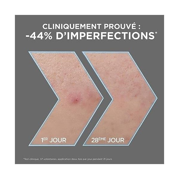 Garnier - Pure Active - Sérum Anti-Points Noirs & Imperfections au Charbon - 4% Niacinamide, Acide Salicylique & Acide Lactiq...