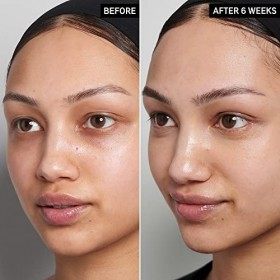 The INKEY List 15&nbsp;% Vitamin C and EGF Serum aide à éclaircir intensément tous les types de peaux 30&nbsp;ml