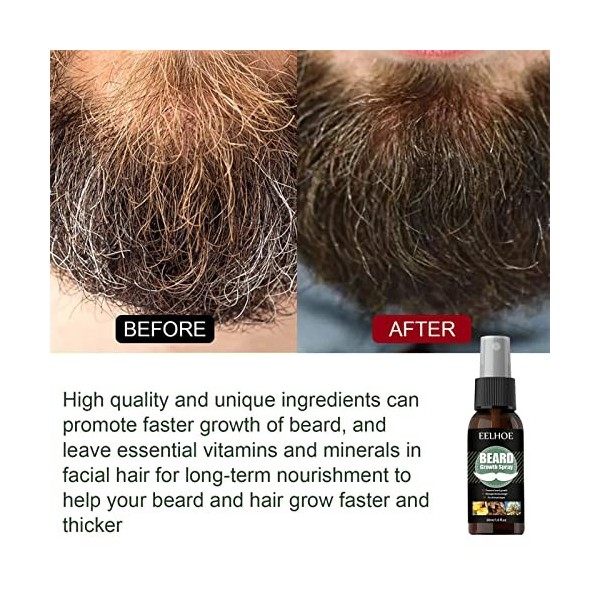 Fulenyi Beard Growth Kit dentretien de la barbe 30 ml pour homme, barbe, derma roller, sérum, huile et baume à barbe