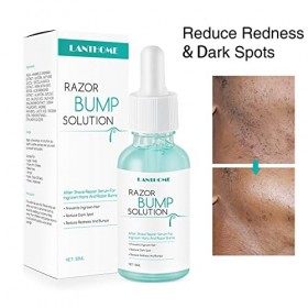 Maodom Razor Bumps Essence - 30 ML dessence pour Les Bosses du Rasoir et Les Poils incarnés | Soins de la Peau pour Le Visag