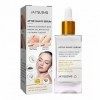 Ohicki Essence Contre Les Poils incarnés - Traitements des Poils incarnés et des Bosses du Rasoir 90 ML - Soins de la Peau po