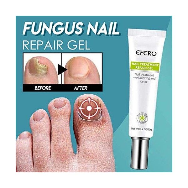 Générique Gel Traitement Pieds réparation Soins des Ongles blanchiment de longle Toe Soins personnels de la Peau Appareil Vi