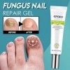 Générique Gel Traitement Pieds réparation Soins des Ongles blanchiment de longle Toe Soins personnels de la Peau Appareil Vi