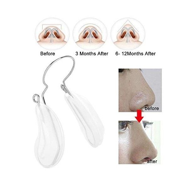 Pince-nez, Redresseur de nez Nez Up Shaping Lifting Redressing Clip Bridge Enhancer Beauty Reshaper Safety Silicone Pads Care