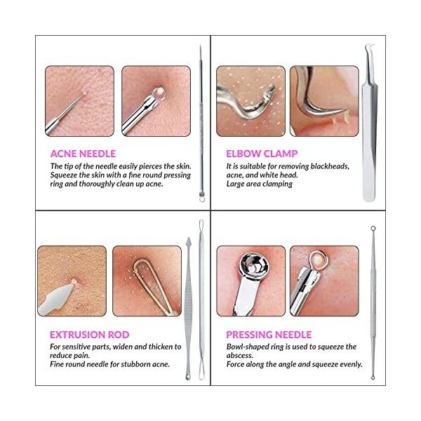 1st Deer Extracteur Point Noir de Acné, 5 Pcs Kit Extracteur Professional Pince Point Noir pour Retire Comédons, les Boutons ...
