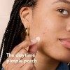 Mighty Patch Invisible Hydrocolloid Acne Pimple Patch Ultra Thin Spot Treatment 39 count for Face and Day, Vegan, Cruelty-F