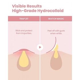 Patch Blemishield de Glam Up 36 patchs - Patchs contre lacné, autocollants pour boutons, patchs hydrocolloïdes Blemish Cur