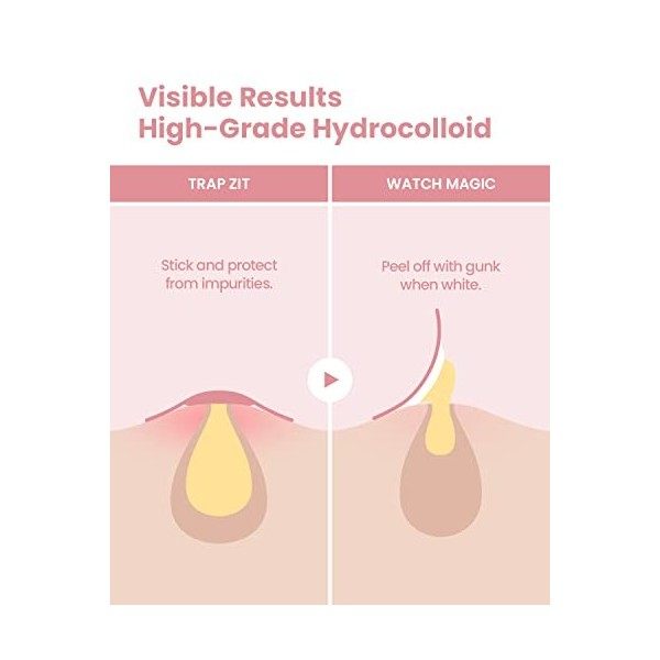 Patch Blemishield de Glam Up 36 patchs - Patchs contre lacné, autocollants pour boutons, patchs hydrocolloïdes Blemish Cur Cr...