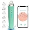Aspirateur Point Noir, prabensei Nettoyant Pour Pores Du Visage Visible WIFI Amélioré Avec Caméra à Boutons Avec 6 Têtes das ...