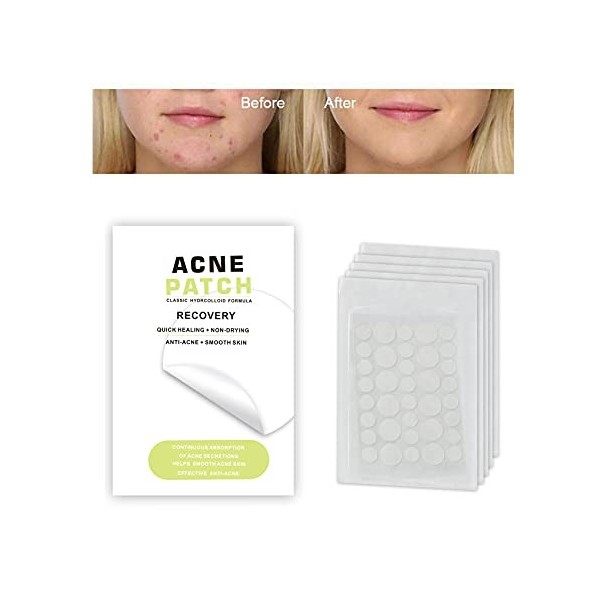 Rpanle 180 PCS Patchs dacné, Patch Anti Bouton, Patch Bouton Acne, Acné Pimple Patch, Patch Anti-Acné Absorbant Acné de Bout ...