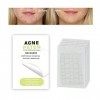 Rpanle 180 PCS Patchs dacné, Patch Anti Bouton, Patch Bouton Acne, Acné Pimple Patch, Patch Anti-Acné Absorbant Acné de Bout ...