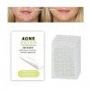 Rpanle 180 PCS Patchs dacné, Patch Anti Bouton, Patch Bouton Acne, Acné Pimple Patch, Patch Anti-Acné Absorbant Acné de Bout