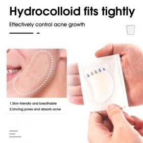 Patchs anti-acné hydrocolloïdes, housse de contrôle de lacné, patch de bouton de taille extra large pour couvrir les grandes