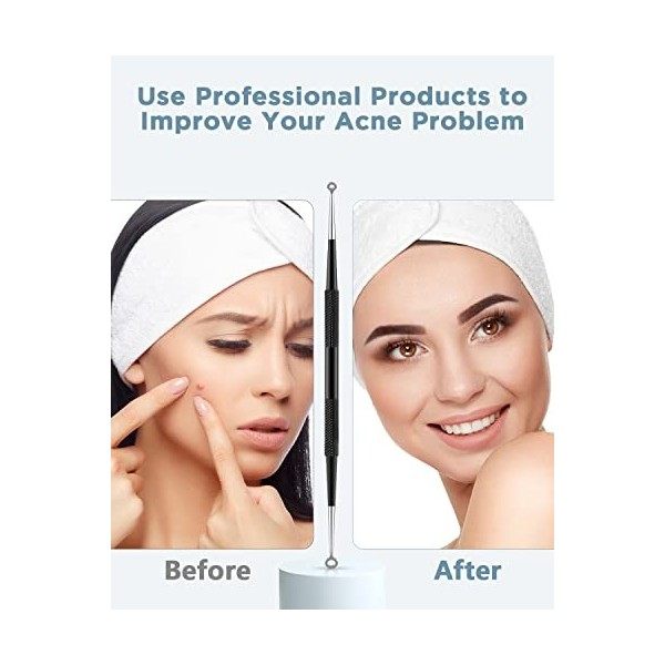 BESTOPE Outil dextracteur de comédons pour enlever lacné - Traitement contre les imperfections, les points blancs, le zit p C...