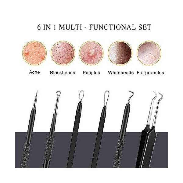 Boxoyx Kit de 6 extracteurs de comédons avec étui en métal pour retirer rapidement et facilement les boutons, points noirs, p...
