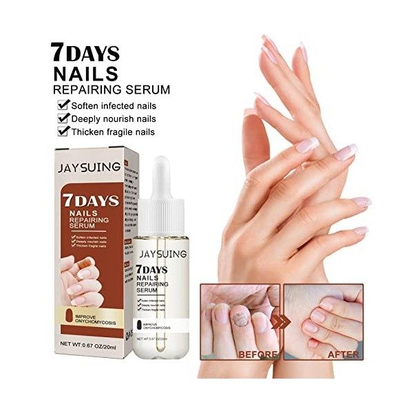 7 Days Nail Repair Essence - Liquide de réparation des ongles de type épaississant pour réparer et embellir les ongles