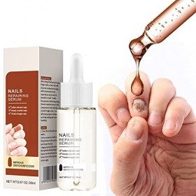 GFOUK 7 Days Nail Growth & Strengthening Oil Serum,Natural Toenail Treatment Oil,Nail Repair Solution,Nail Strengthener and N