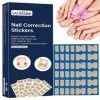 Patchs de réparation des ongles,50pcs produits de soins des ongles confortables et sûrs pour la maison | Patch de correction 