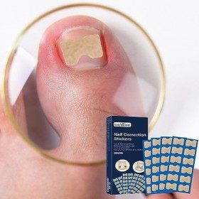 Patchs de réparation des ongles,50pcs produits de soins des ongles confortables et sûrs pour la maison | Patch de correction 