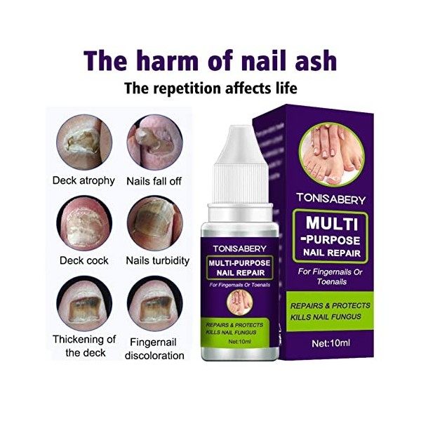 Caneem Huile de réparation pour ongles - Formule traiter et éliminer lessence de renouvellement des ongles - 10 ml dhuile d