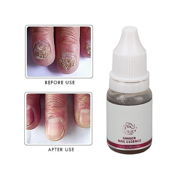 Sérum pour les Ongles au Gingembre de 10 Ml