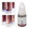 Sérum pour les Ongles au Gingembre de 10 Ml