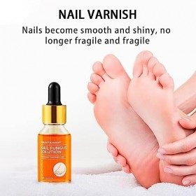 Réparation dongles Liquide de renouvellement des ongles - 15 ml de solution pour les ongles Croissance des ongles pour la fo