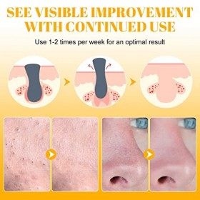 Patch Point Noir, 80 Patches Point Noir Nez, Patchs de nettoyage en des pores du nez pour lélimination des points noirs Crème...