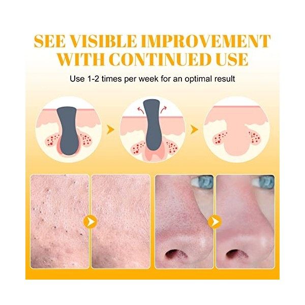 Patch Point Noir, 80 Patches Point Noir Nez, Patchs de nettoyage en des pores du nez pour lélimination des points noirs Crème...