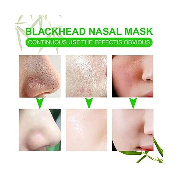 Lot de 80 patch nez point noir, patch point noir visage, patch anti point noir nez visage, le nettoyage en profondeur des por...