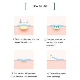 [Some By Mi] Clear Spot Patch Lot de 18 patchs transparents 10 mm x 9 ea + 12 mm x 9 ea Crème Jour et Nuit