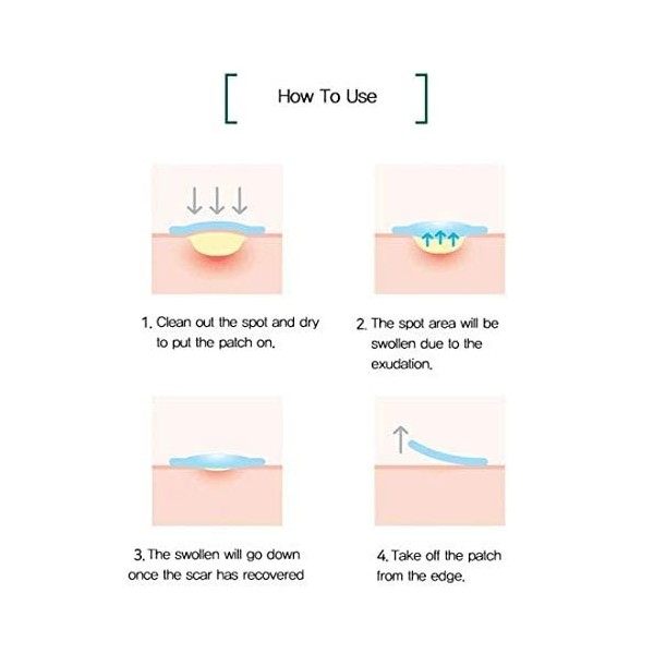 [Some By Mi] Clear Spot Patch Lot de 18 patchs transparents 10 mm x 9 ea + 12 mm x 9 ea Crème Jour et Nuit