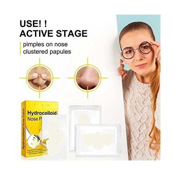 Lot de 12 Patchs pour le Nez, Patchs Hydrocolloïdes pour les Pores du Nez, le Nettoyage des Points Noirs et de lacné, les Ba ...