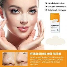 10pcs Bandes de Nettoyage des Pores, Patchs Hydrocolloïdes BBlackhead Remover Pore Strips Nettoyage en Profondeur des Pores p