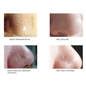 Pansements Pour Le Nez - 50 Strips Pour Le Nez Contre Les Points Noirs, Points Noirs, Bande Pour Affiner La Peau Biore Nose S...