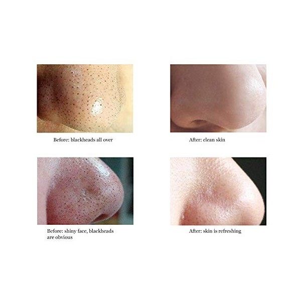 Pansements Pour Le Nez - 50 Strips Pour Le Nez Contre Les Points Noirs, Points Noirs, Bande Pour Affiner La Peau Biore Nose S...