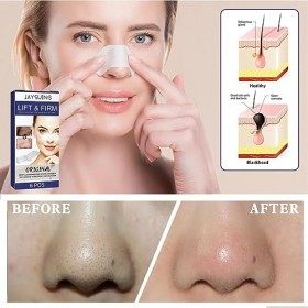 Bandes nasales pour les pores | Minimiseur de pores 6 pièces,Enlèvement instantané des, bandes nasales nettoyantes en profond
