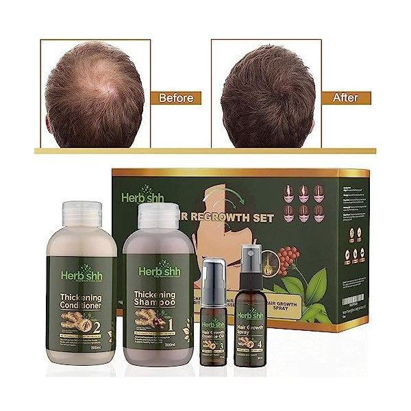 Herbishh Thickening Shampoo and Conditioner |Hair Growth Vitalizer |Hair Growth Essence Oil | Prevents Premature Hair loss- S