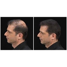 Kmax Fibres capillaires pour cheveux clairsemés, contre la perte de cheveux, recharge de 55 g CASTANO SCURO