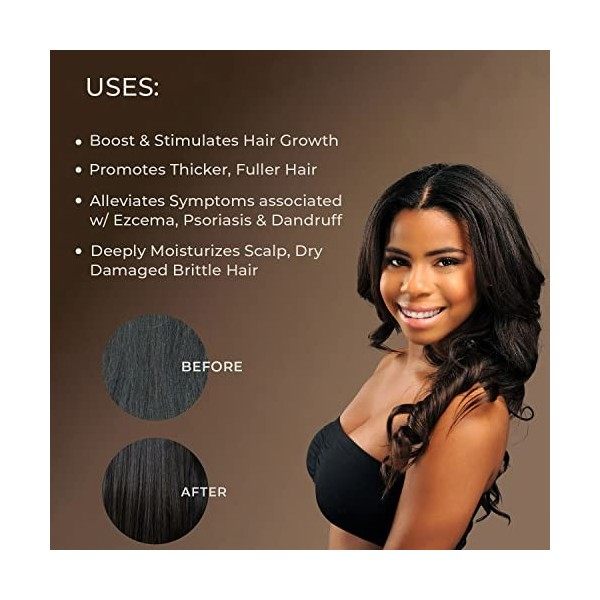 Sunny Isle Huile de ricin noire jamaïcaine, 8 onces | Bouteille en plastique PET | Original | Pour des cheveux, une peau, des