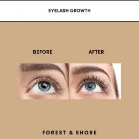 Huile de ricin 100 % naturelle et biologique pour la croissance des cheveux, des sourcils, des cils et de la peau