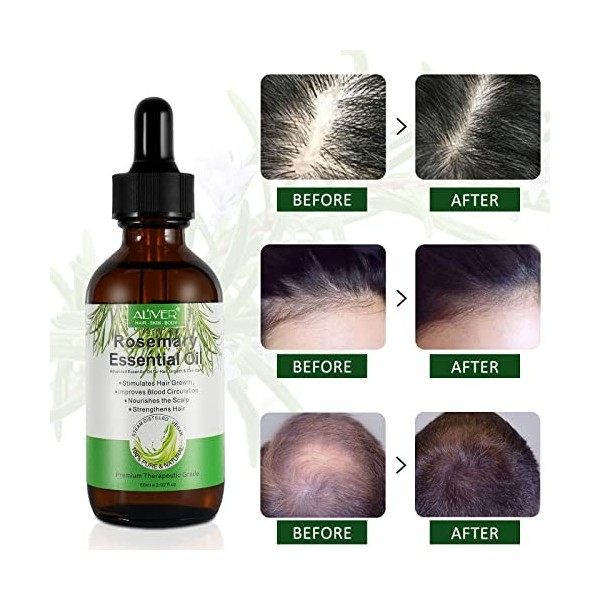 Huile de Romarin Pour Cheveux, Rosemary Oil for Hair Growth & Skin