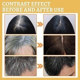 DARKA Sérum cheveux grisants 5 pièces, DARKA PRO Greying Repair Serum cheveux liquide à base de plantes lotion frisottis S7F1