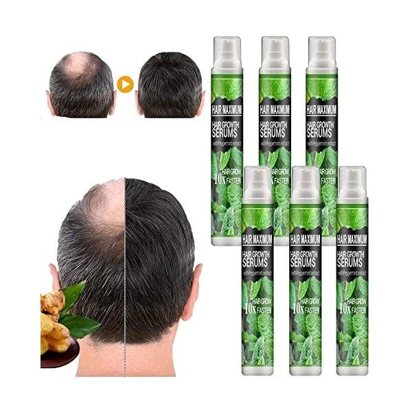 Hair ReBirth Herbal Hair Growth Spray,Anti Hair Loss Hair-Growth Essence Spray Hair Essential Oil,Prevent Hair Loss and Reviv