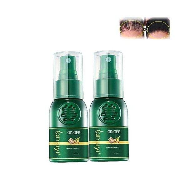 Oveallgo™ Shougagro Spray Japonais Pour La Croissance Des Cheveux, Oveallgo Spray Repousse Cheveux, Oveallgo™ Shougagro Japan